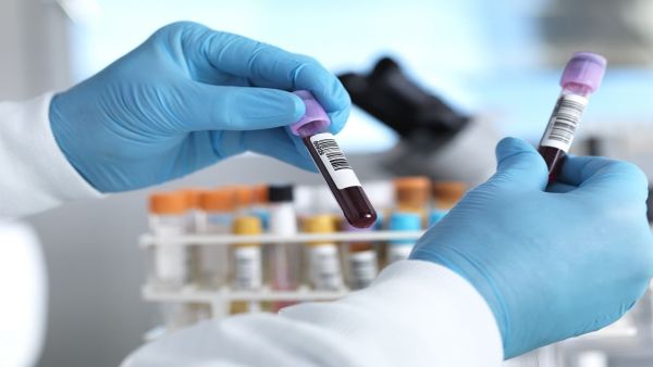 Cribe Blood Group: World's Rare Blood Group found in India, what is the story of Crib