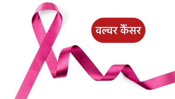 Vulvar Cancer: What happens Valver cancer, why young women are also victims of this
