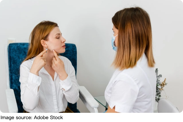 Tuyệt chiêu trị mụn nội tiết