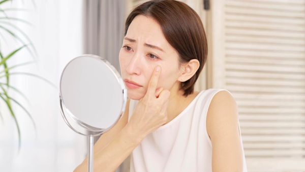 Woman who always has dark circles looking in the mirror.