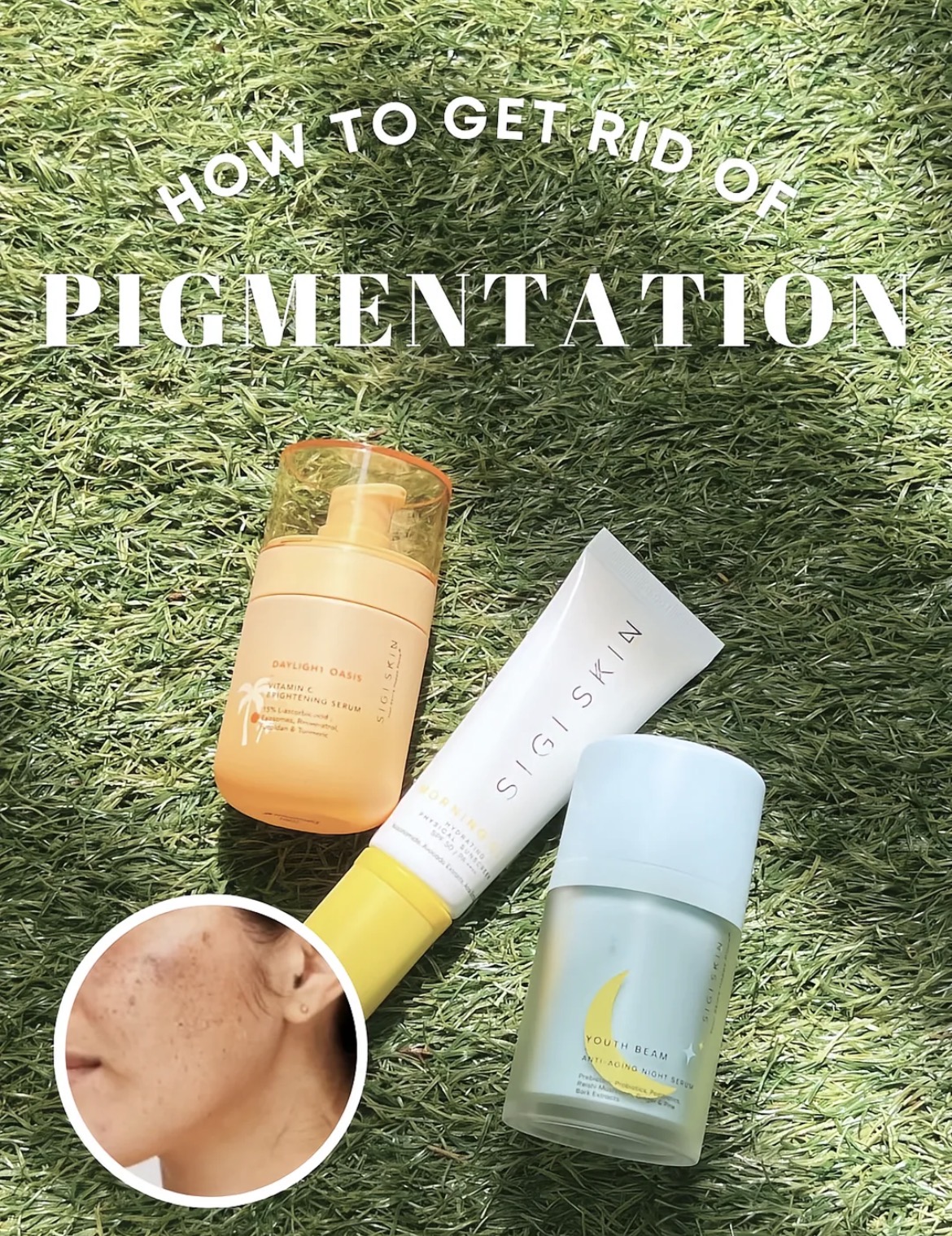 Fade Hyperpigmentation!