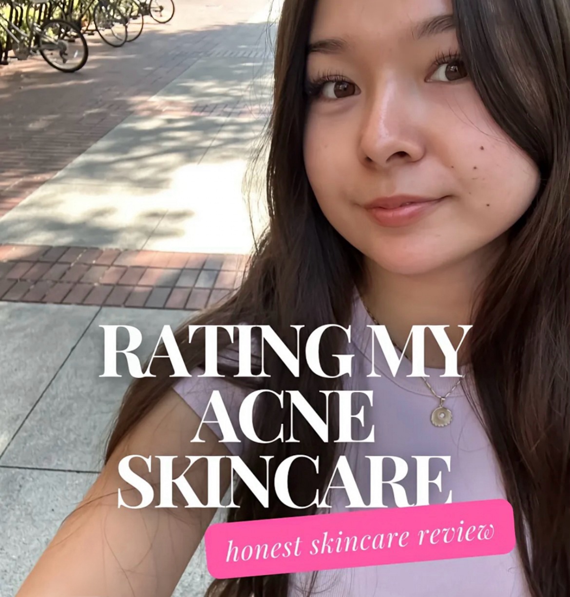 Tratamientos De Acné