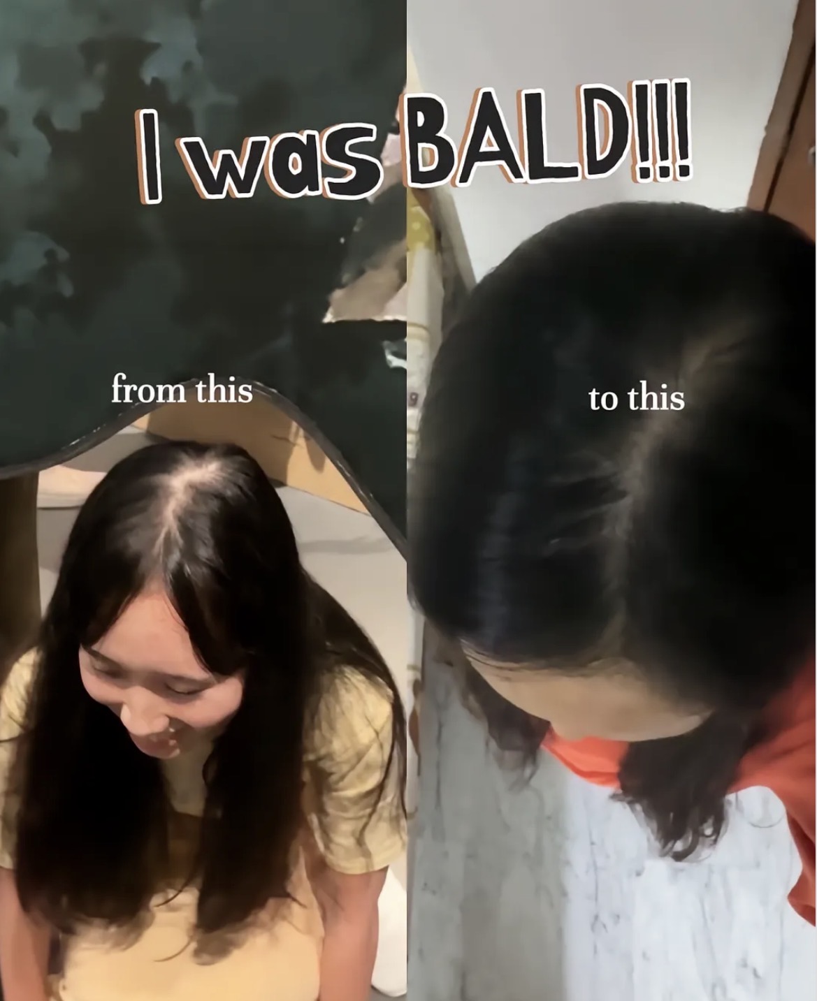 Восстановление волос