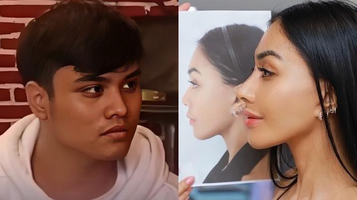 DIGUGAT : Denada ketika melakukan operasi plastik (oplas) hidung. Ia melakukannya untuk mempertahankan kariernya (Kanan) Denada Elizabeth Anggia Ayu Tambunan atau yang akrab disapa Denada, tengah menghadapi gugatan hukum di Pengadilan Negeri (PN) Banyuwangi. Gugatan tersebut dilayangkan oleh seorang pemuda asal Banyuwangi, Jawa Timur, bernama Ressa Rizky Rossano (24). Ressa menggugat Denada atas dugaan perbuatan melawan hukum, yakni penelantaran anak kandung