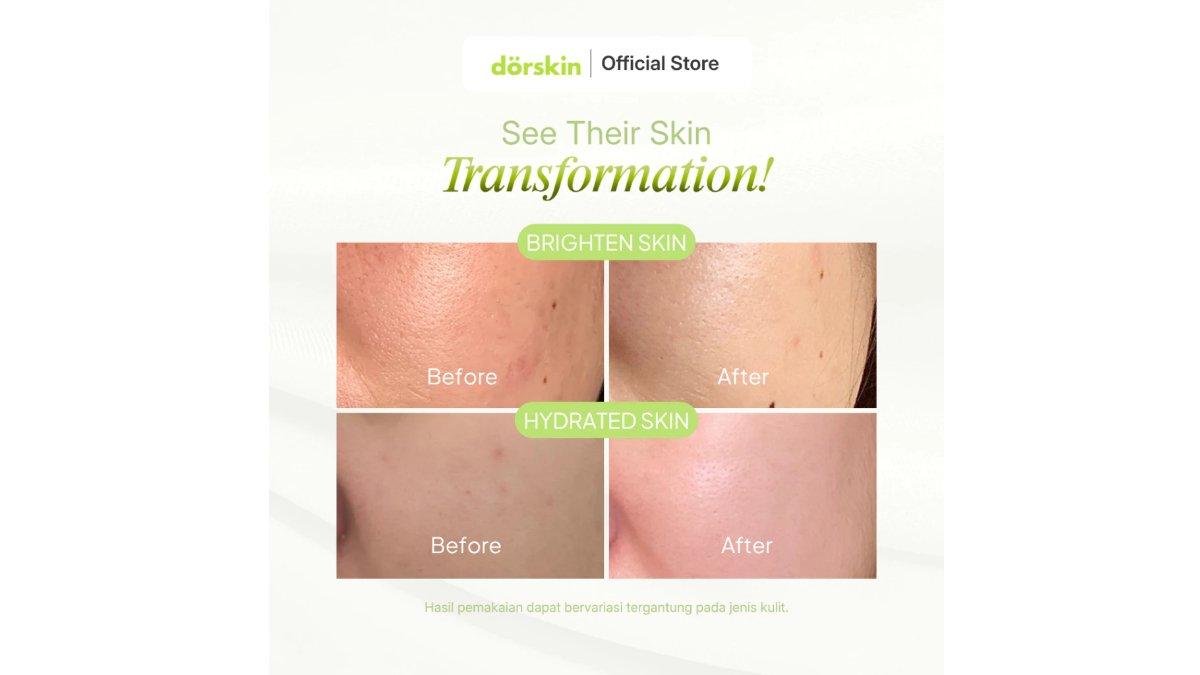 Dorskin Pink Bliss Moisturizer