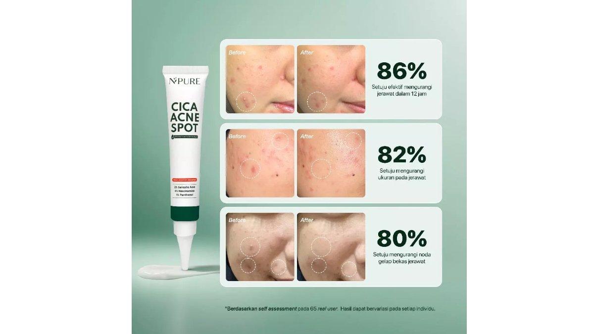 NPURE Cica Acne Spot Cream