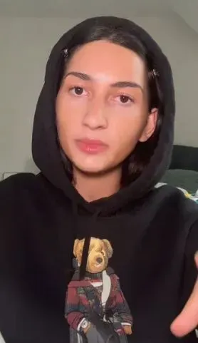 Celaka gegara dry ice Ngeri! Wanita Ini Alami 'Luka Bakar' di Mulut Usai Telan Dry Ice