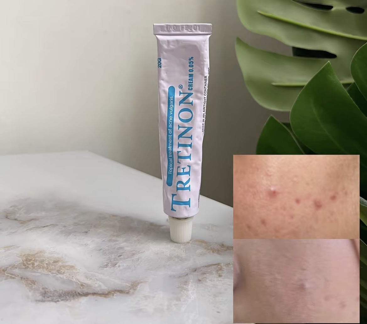 Anti-imperfections ciblées