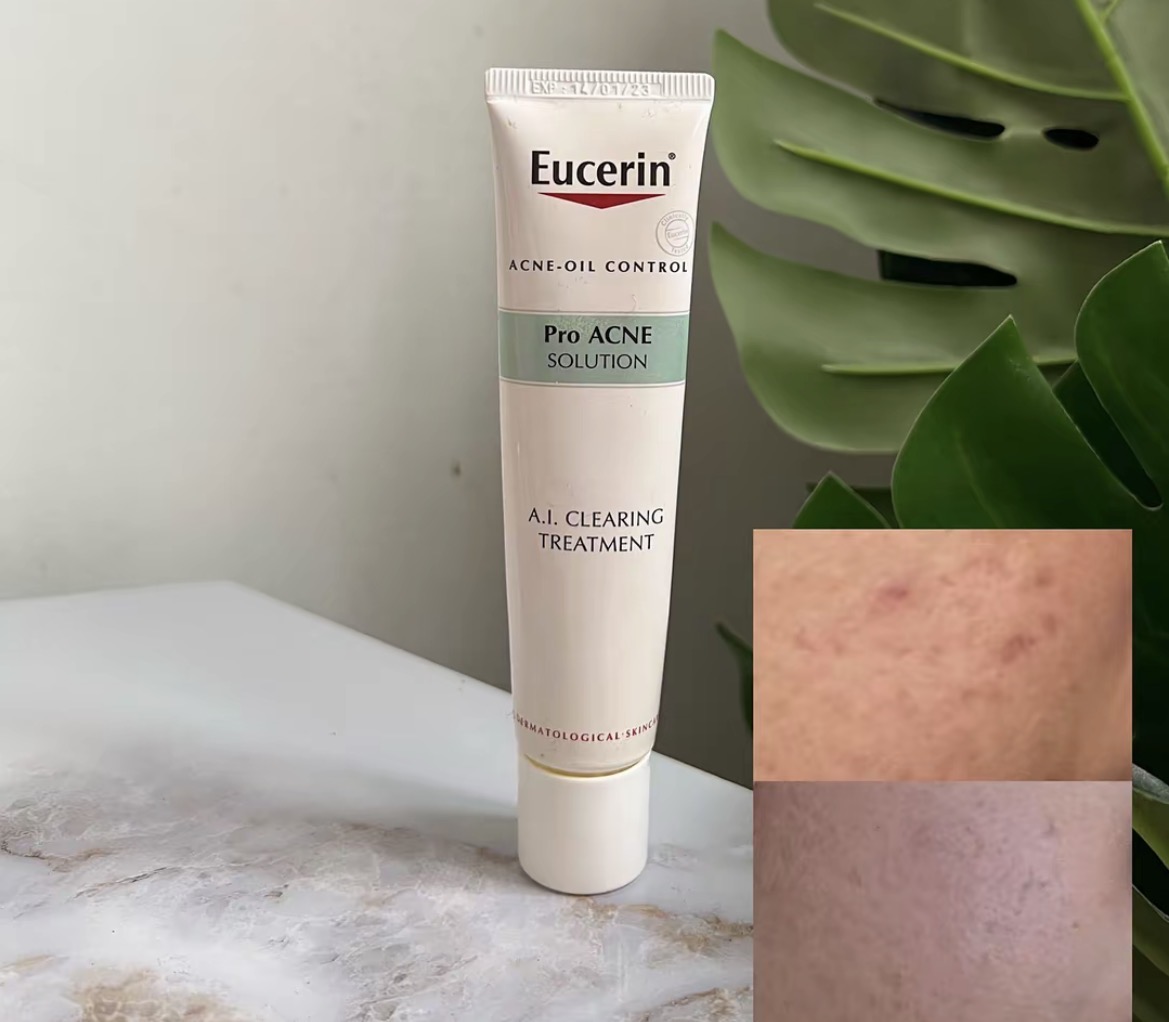 Anti-imperfections ciblées