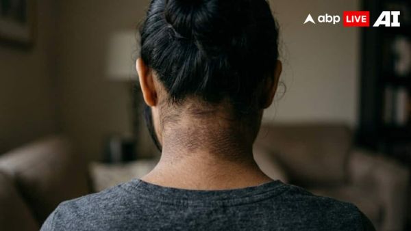 (Image Source: ABPLIVE AI)