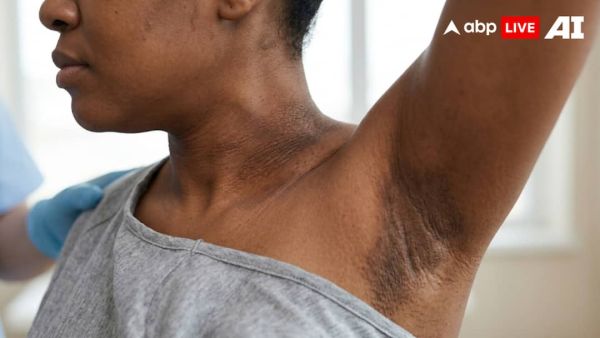 (Image Source: ABPLIVE AI)