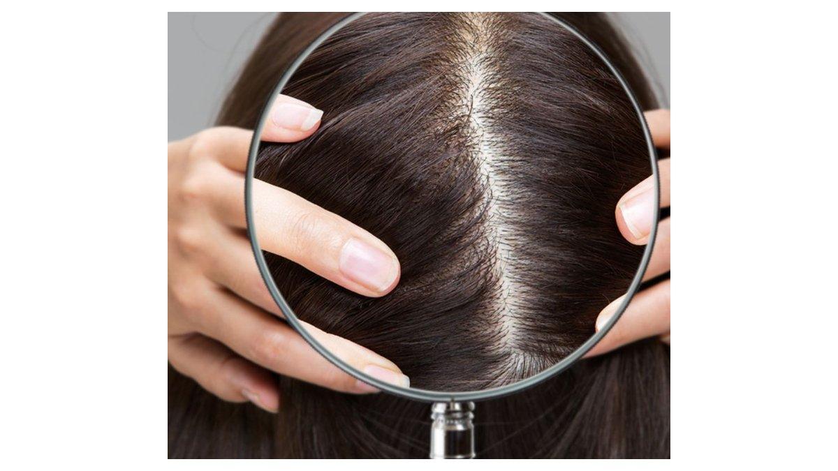 Ilustrasi tips merawat rambut agar tidak rontok dengan menjaga kebersihan kulit kepala