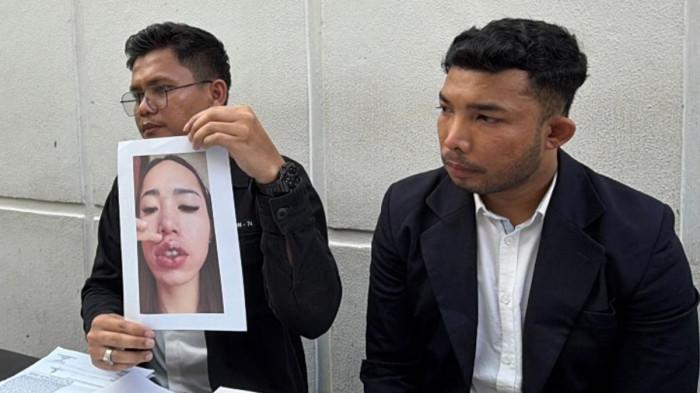 FOTO WAJAH KORBAN -- Kuasa hukum memperlihatkan foto wajah korban yang mengalami rusak akibat praktik dokter kecantikan gadungan, di Pekanbaru, Riau, Selasa (28/4/2026).