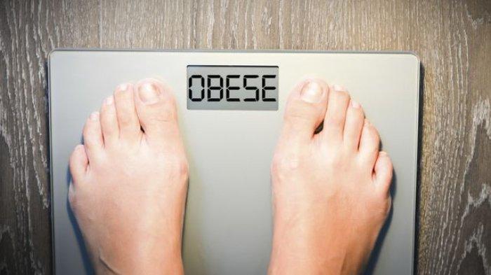 Ilustrasi obesitas