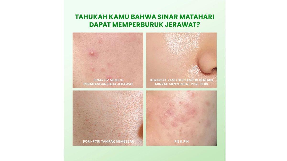 YOU Sunbrella Acne Shield Light Sunscreen