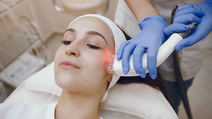 ilustrasi treatment laser untuk mengatasi masalah noda hitam bekas jerawat