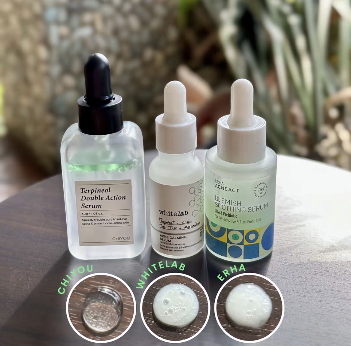 Acne Serums I Swear By