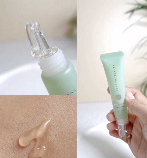 Spot Treatment Jerawat