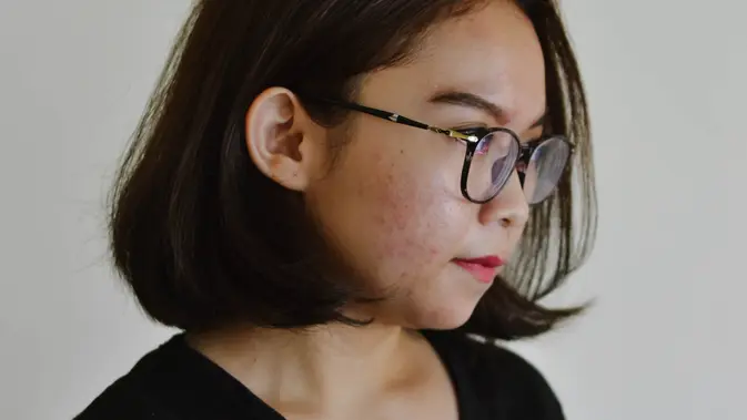 Ilustrasi Ilustrasi moisturizer untuk kulit sensitif. (dok. unsplash/@audreyjackson)