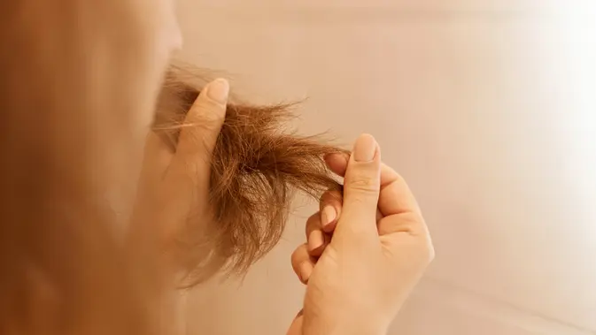 Ilustrasi rambut rontok. (dok. user18526052/Unsplash)